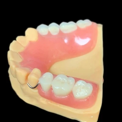 Eemaldatav traatklambriga osaline protees